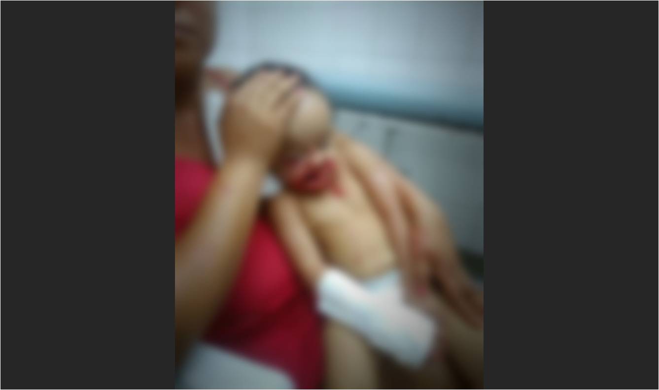 Menina de dois anos é atacada por um Pitbull em Aracaju