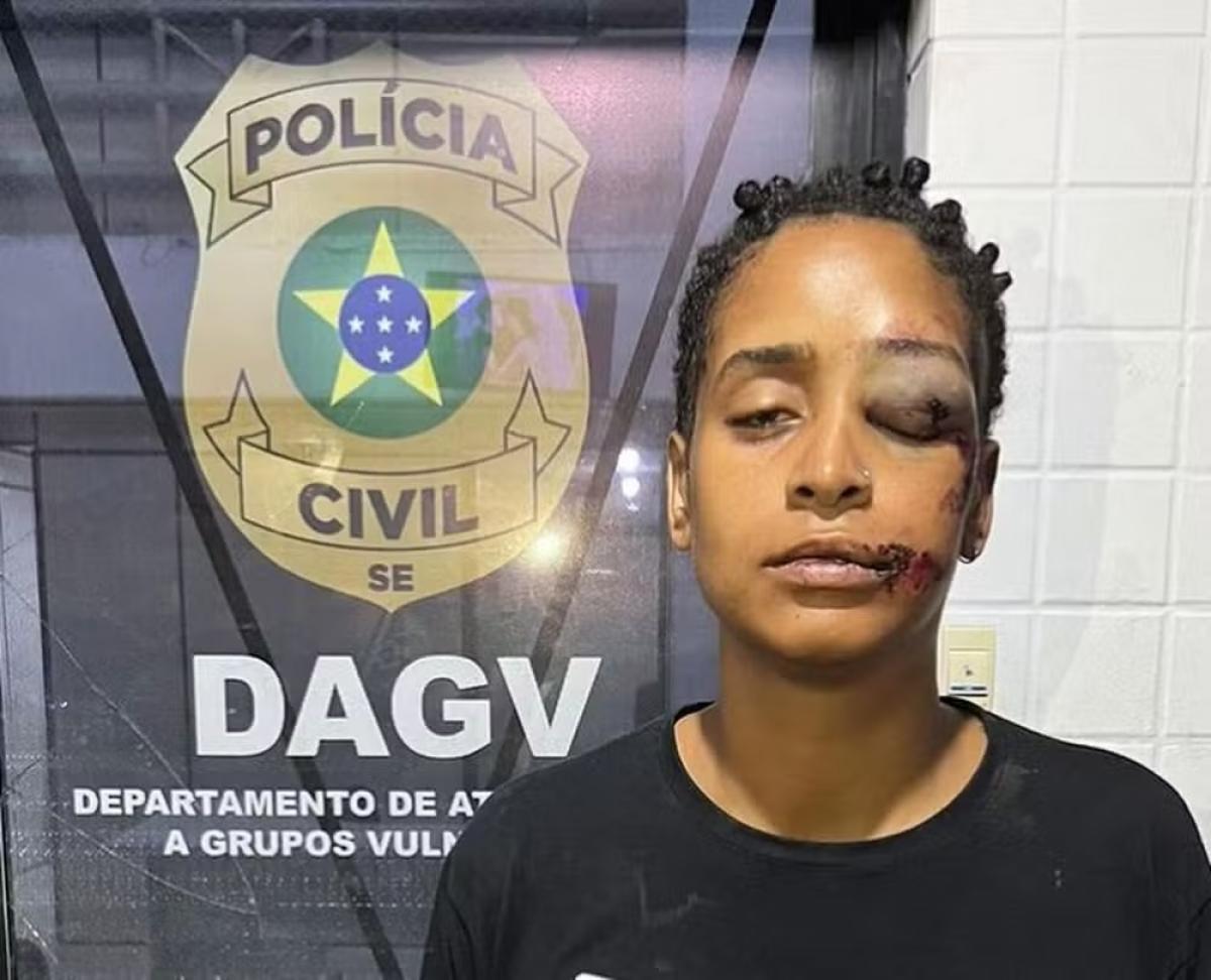 Mulher é agredida em Aracaju e denuncia homofobia como causa da briga