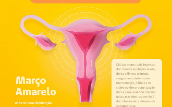 Endometriose causa cólicas incapacitantes e prejudica qualidade de vida
