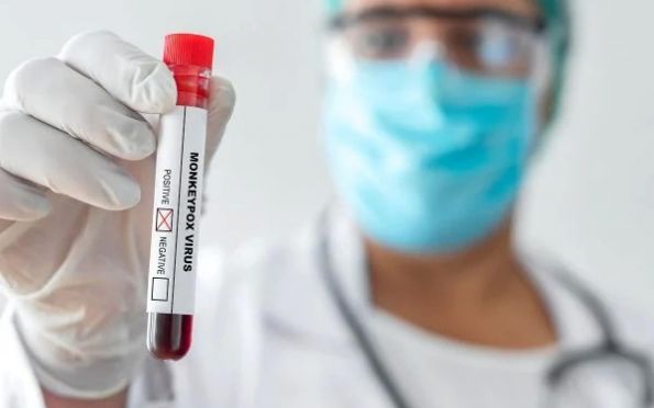 DF investiga primeiros casos suspeitos de varíola dos macacos e hepatite misteriosa