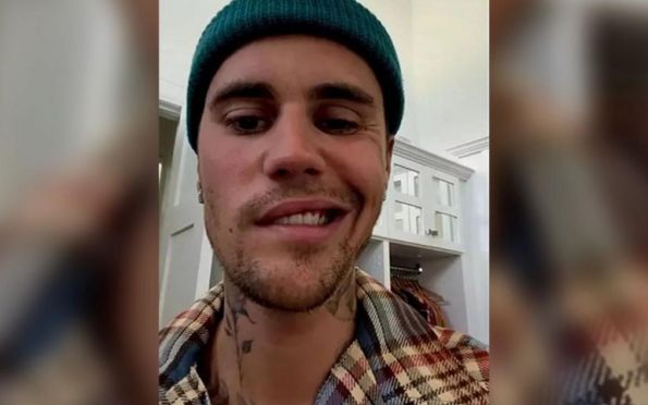 Justin Bieber surge com rosto paralisado e diz que sofre com síndrome