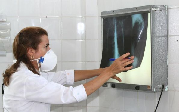 Brasil registra 78 mil novos casos de tuberculose 