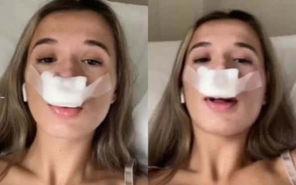 Mulher faz rinoplastia para filhos herdarem “nariz lindo” e vira meme