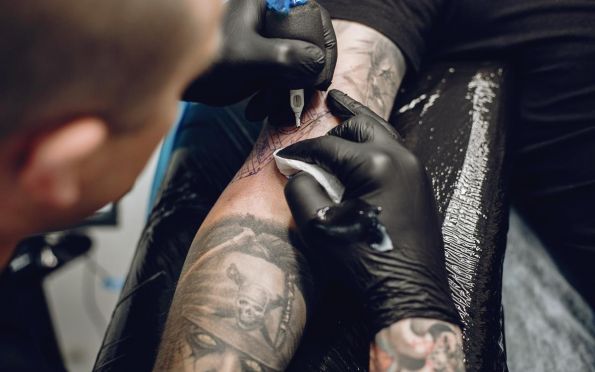Pessoas com tatuagem podem fazer depilação a laser?
