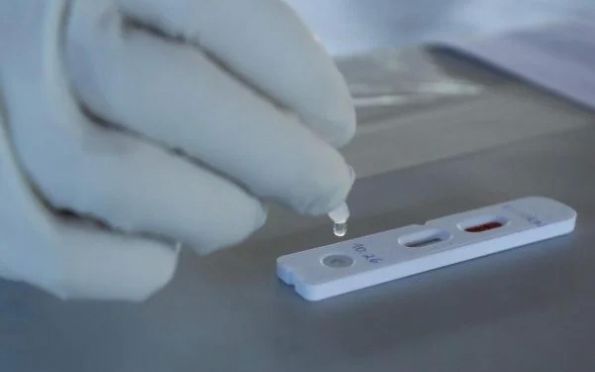 Anvisa autoriza que farmácias realizem testes e exames simples