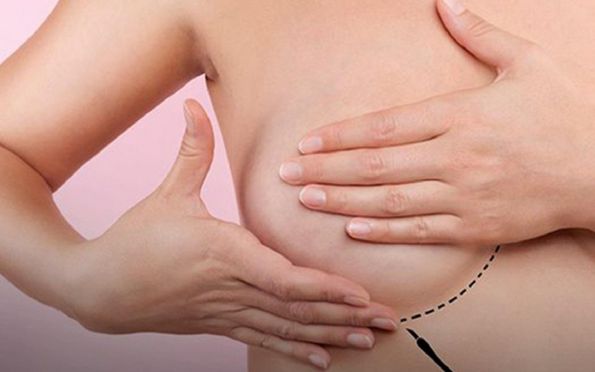 Câncer de mama: estudo identifica novo fator de risco para a doença