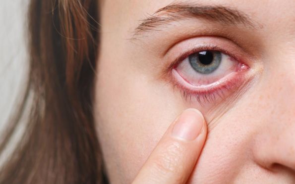 Olho irritado: nova variante da Covid, Arcturus tem sintoma particular