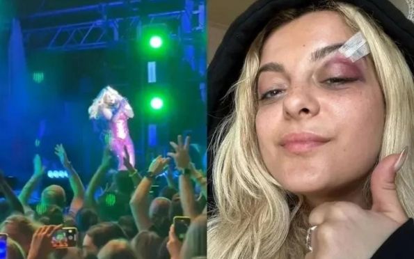 Bebe Rexha retoma turnê após ser atingida por celular no rosto