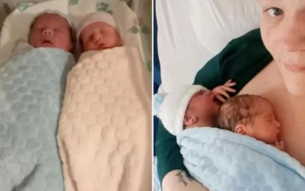 Gêmeos simultâneos: bebês nascem ao mesmo tempo em parto raro