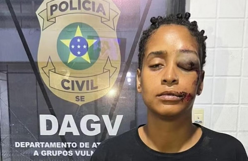 Suspeito de racismo e LGBTfobia em lanchonete de Aracaju é intimado