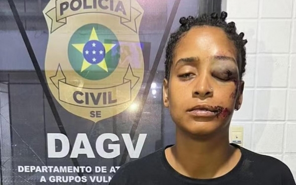 Mulher é agredida em Aracaju e denuncia homofobia como causa da briga